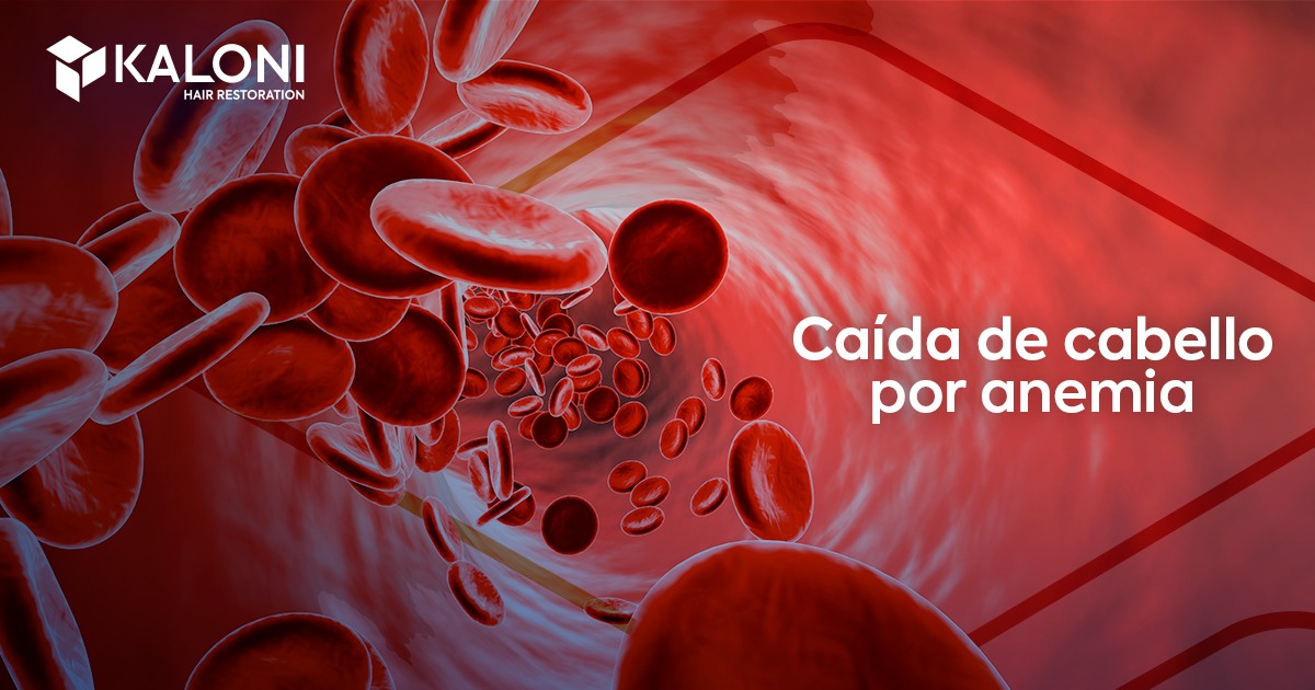 caída de cabello por anemia