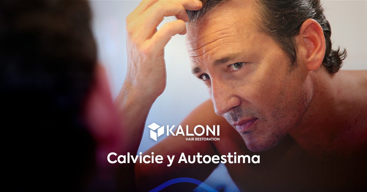 calvicie-autoestima-portada