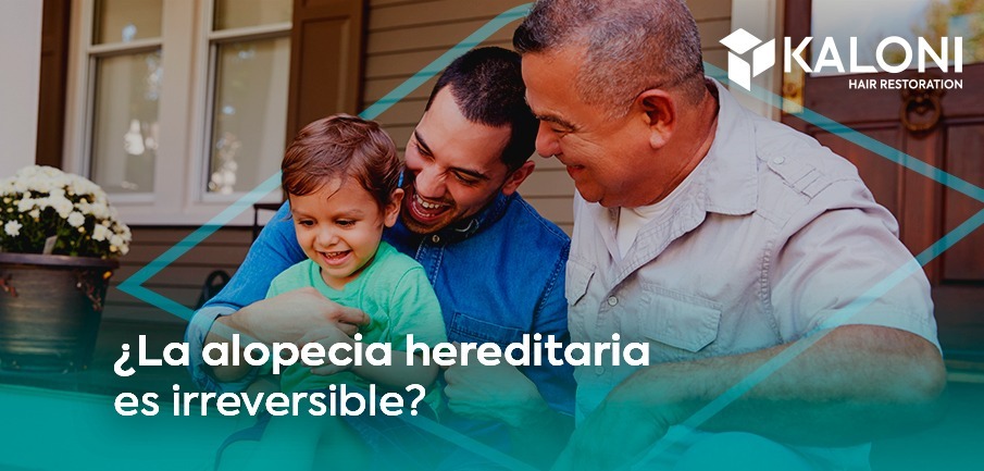 alopecia-hereditaria-portada